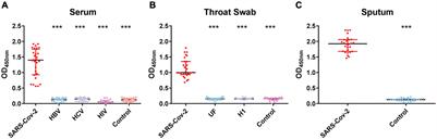 Respiratory Mucosal Immunity: Kinetics of Secretory Immunoglobulin A in Sputum and Throat Swabs From COVID-19 Patients and Vaccine Recipients